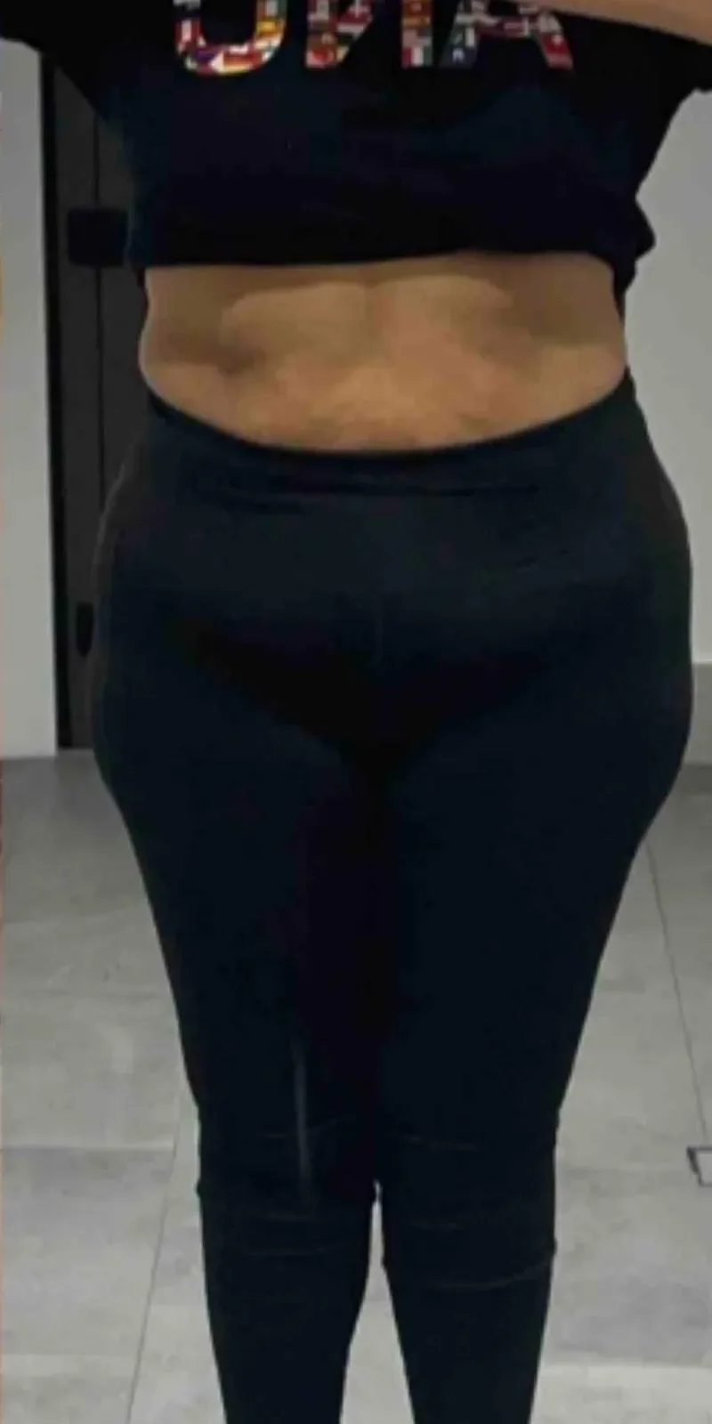 After — Sustainable fat loss
